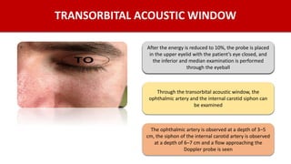 TRANSORBITAL ACOUSTIC WINDOW
After the energy is reduced to 10%, the probe is placed
in the upper eyelid with the patient’s eye closed, and
the inferior and median examination is performed
through the eyeball
Through the transorbital acoustic window, the
ophthalmic artery and the internal carotid siphon can
be examined
The ophthalmic artery is observed at a depth of 3–5
cm, the siphon of the internal carotid artery is observed
at a depth of 6–7 cm and a flow approaching the
Doppler probe is seen
After the energy is reduced to 10%, the probe is placed
in the upper eyelid with the patient’s eye closed, and
the inferior and median examination is performed
through the eyeball
 