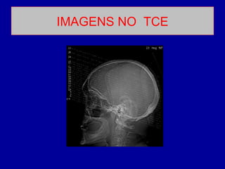 IMAGENS NO TCE
 