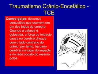 Traumatismo Crânio-Encefálico -
TCE
Contra-golpe: descreve
contusiões que ocorrem em
um dos lados do cerebro.
Quando a cabeça é
golpeada, a força do impacto
causa no cerebro choque
com o lado contrario do
crânio, por tanto, há dano
cerebral no lugar do impacto
e no lado oposto do mesmo
golpe.
 