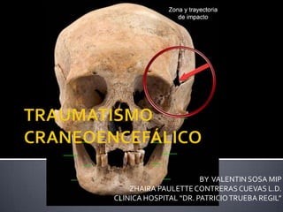 TRAUMATISMO CRANEOENCEFÁLICO BY  VALENTIN SOSA MIP ZHAIRA PAULETTE CONTRERAS CUEVAS L.D. CLINICA HOSPITAL “DR. PATRICIO TRUEBA REGIL” 