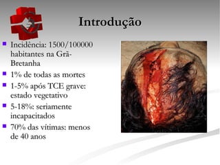 Introdução Incidência: 1500/100000 habitantes na Grã-Bretanha 1% de todas as mortes 1-5% após TCE grave: estado vegetativo 5-18%: seriamente incapacitados 70% das vítimas: menos de 40 anos 