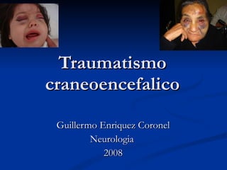 Traumatismo craneoencefalico Guillermo Enriquez Coronel Neurologia  2008 