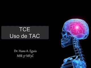 TCE
Uso de TAC

 Dr. Hans A. Eguía
   MIR 3º MFyC
 