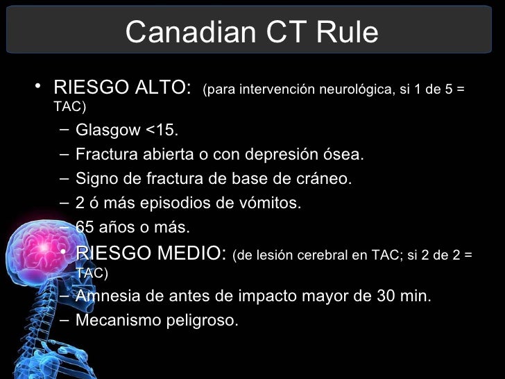 Traumatismo Craneoencefálico leve