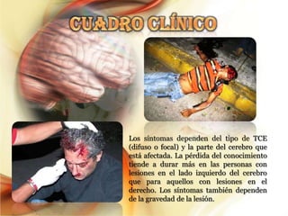 Los síntomas dependen del tipo de TCE
(difuso o focal) y la parte del cerebro que
está afectada. La pérdida del conocimiento
tiende a durar más en las personas con
lesiones en el lado izquierdo del cerebro
que para aquellos con lesiones en el
derecho. Los síntomas también dependen
de la gravedad de la lesión.
 