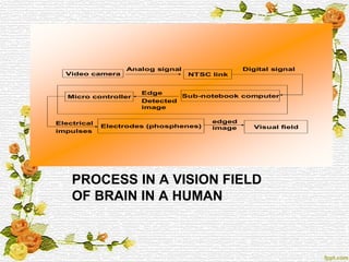 PROCESS IN A VISION FIELD
OF BRAIN IN A HUMAN
Video camera
Analog signal
NTSC link
Digital signal
Sub-notebook computerMicro controller
Edge
Detected
image
Electrical
impulses
Electrodes (phosphenes) Visual field
edged
image
 