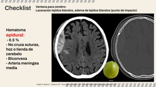 Checklist
Hematoma
epidural:
- 0.5 %
- No cruza suturas,
hoz o tienda de
cerebelo
- Biconvexa
- Arteria meningea
media
Ventana para cerebro:
Laceración tejidos blandos, edema de tejidos blandos (punto de impacto)
Wright D, Merck L. Capítulo 257: Traumatismo cefálico. En: Tintinalli. Medicina de Urgencias, 8a ed. 2017.
 