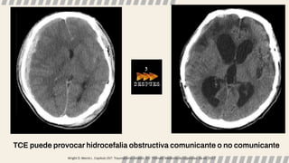 TCE puede provocar hidrocefalia obstructiva comunicante o no comunicante
Wright D, Merck L. Capítulo 257: Traumatismo cefálico. En: Tintinalli. Medicina de Urgencias, 8a ed. 2017.
 