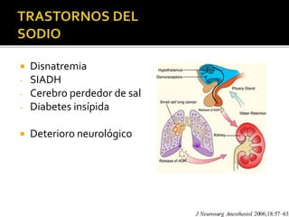  Disnatremia 
- SIADH 
- Cerebro perdedor de sal 
- Diabetes insípida 
 Deterioro neurológico 
 