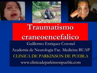Traumatismo
craneoencefalico
Guillermo Enriquez Coronel
Academia de Neurologia Fac. Medicina BUAP
CLINICA DE PARKINSON DE PUEBLA
www.clinicadeparkinsonpuebla.com
 