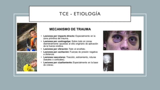 TCE - ETIOLOGÍA
 