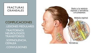 FRACTURAS
CRANEALES
COMPLICACIONES
. LESIONES MEDULARES
.TRASTORNOS
NEUROLÓGIOS
TRANSITORIOS
. SOMNOLENCIA,
CEFALEA
. CONVULSIONES
 