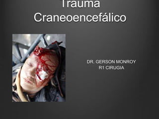 Trauma
Craneoencefálico
DR. GERSON MONROY
R1 CIRUGIA
 