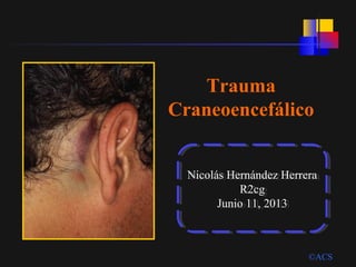 Trauma
Craneoencefálico
Nicolás Hernández Herrera
Nicolás Hernández Herrera
R2cg
R2cg
Junio 11, 2013
Junio 11, 2013

©ACS

 