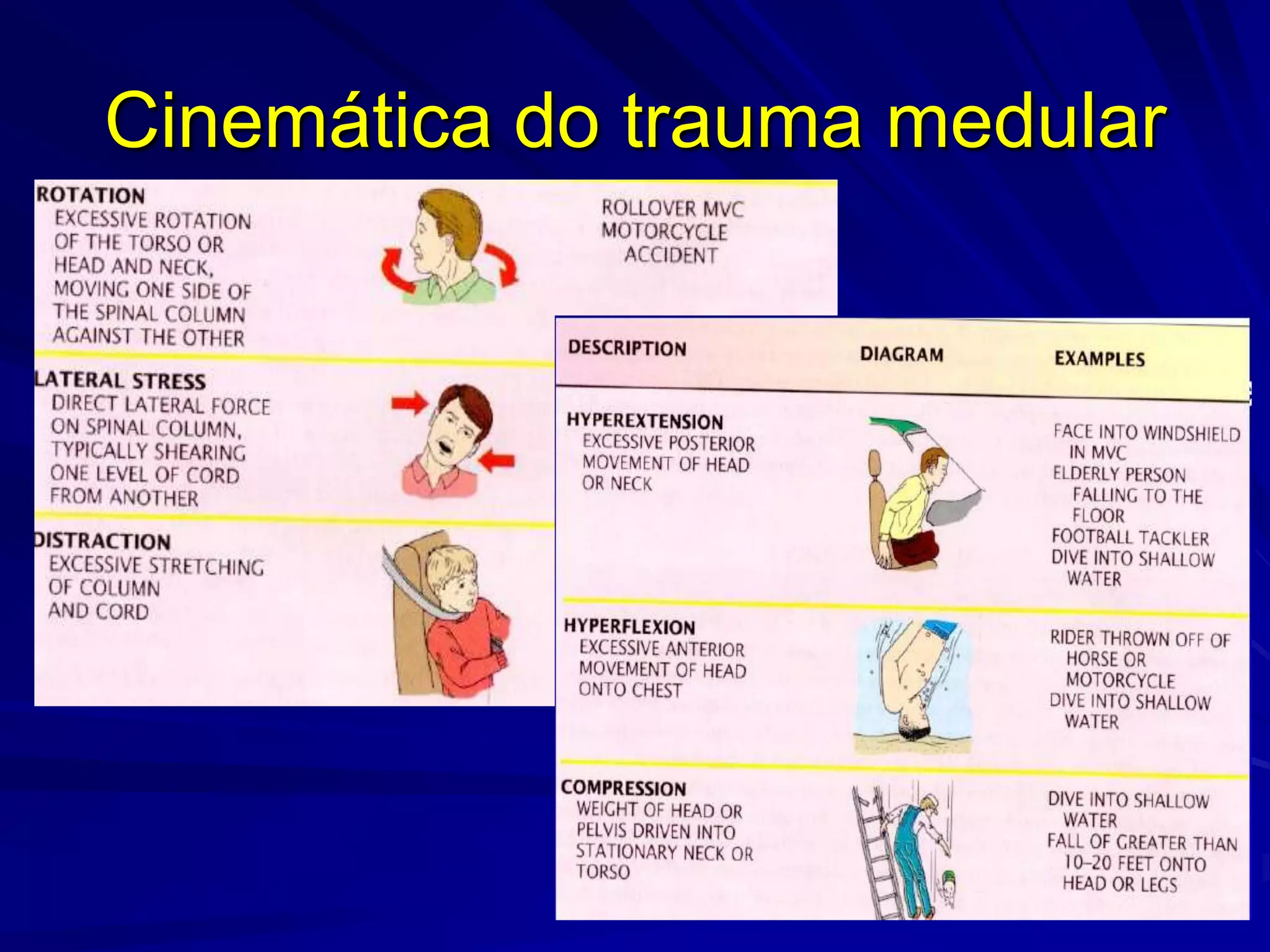 Cinemática do trauma medular
 