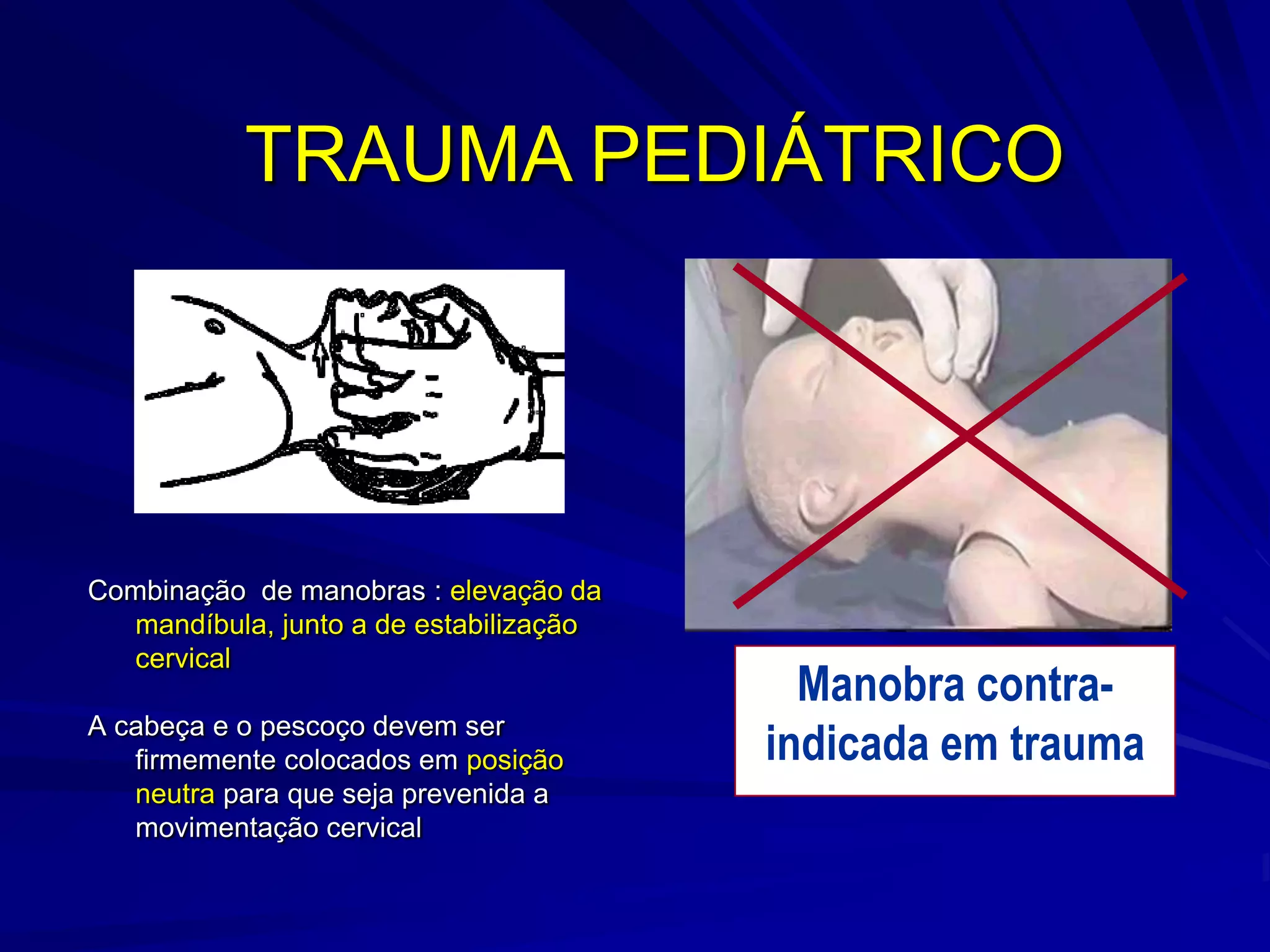 TRAUMA PEDIÁTRICO




Combinação de manobras : elevação da
  mandíbula, junto a de estabilização
  cervical
                                          Manobra contra-
A cabeça e o pescoço devem ser
   firmemente colocados em posição      indicada em trauma
   neutra para que seja prevenida a
   movimentação cervical
 