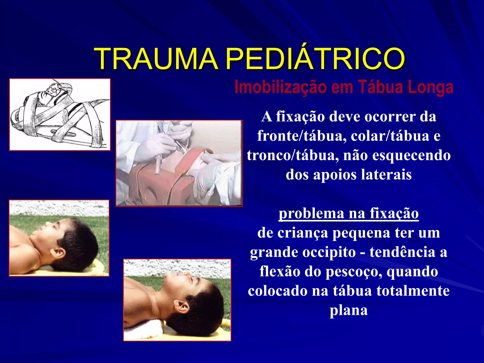 TRAUMA PEDIÁTRICO
       Imobilização em Tábua Longa
           A fixação deve ocorrer da
          fronte/tábua, colar/tábua e
        tronco/tábua, não esquecendo
               dos apoios laterais

             problema na fixação
         de criança pequena ter um
        grande occipito - tendência a
          flexão do pescoço, quando
        colocado na tábua totalmente
                    plana
 