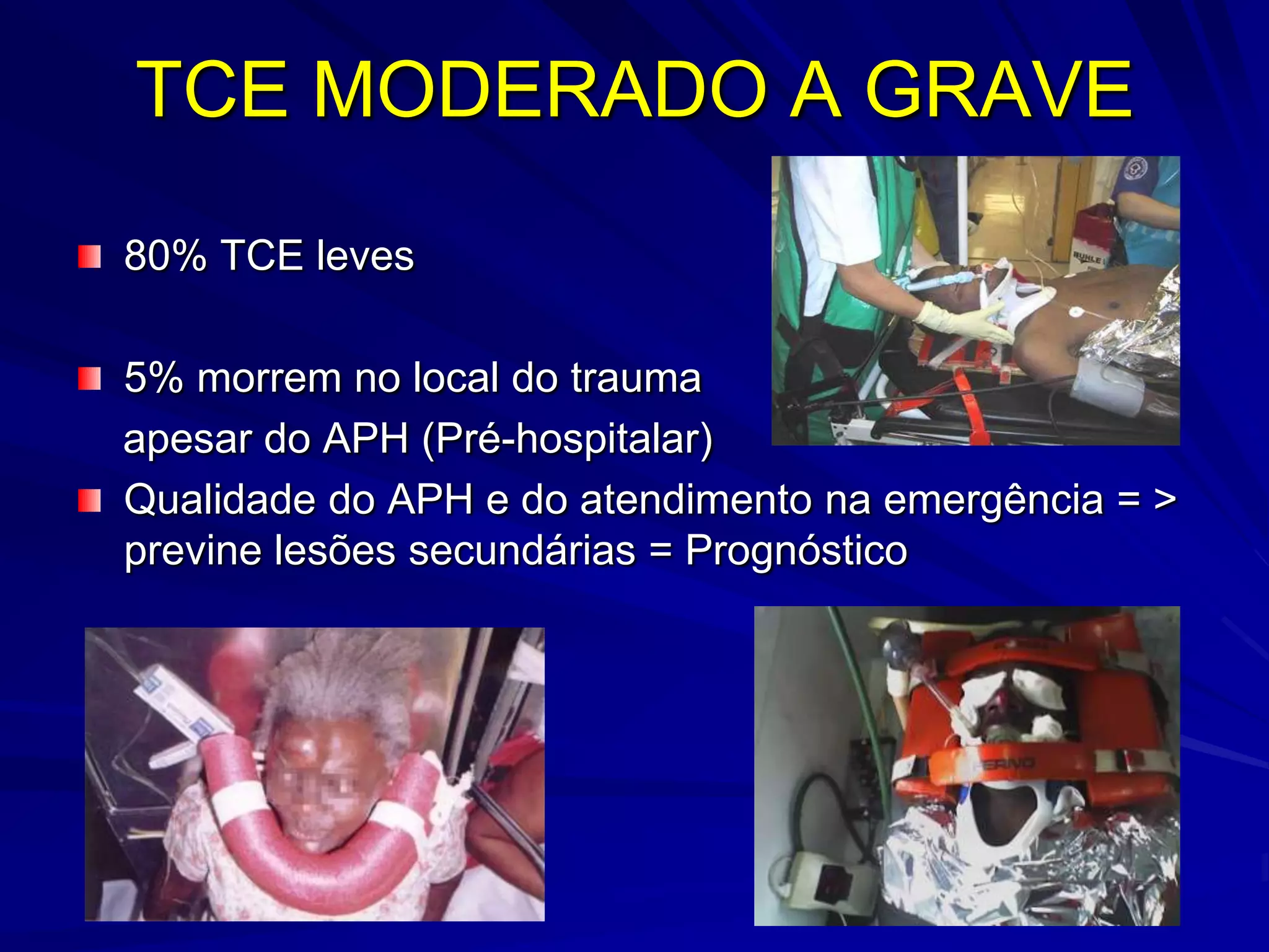 TCE MODERADO A GRAVE
80% TCE leves

5% morrem no local do trauma
apesar do APH (Pré-hospitalar)
Qualidade do APH e do atendimento na emergência = >
previne lesões secundárias = Prognóstico
 