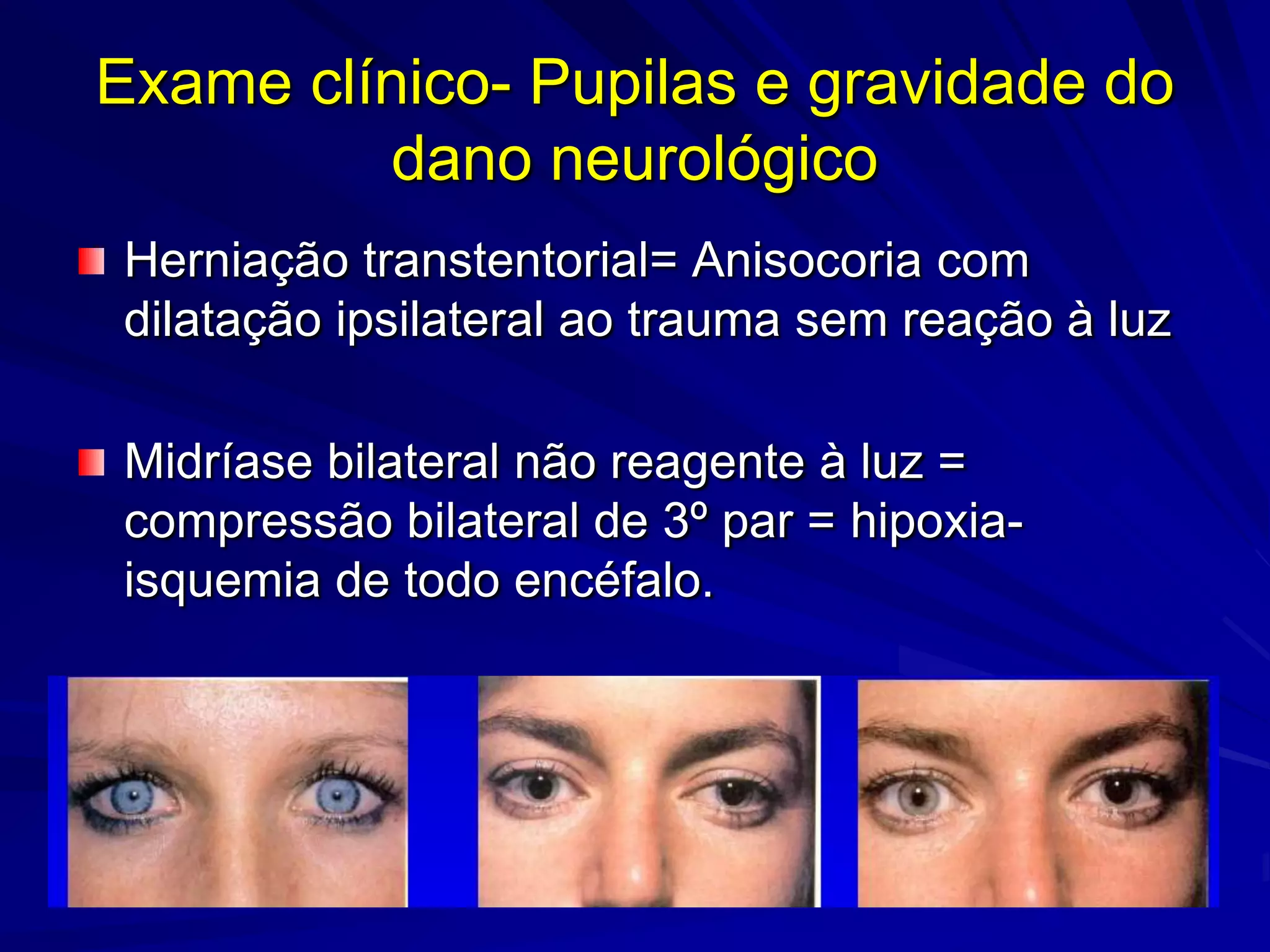 Exame clínico- Pupilas e gravidade do
         dano neurológico
Herniação transtentorial= Anisocoria com
dilatação ipsilateral ao trauma sem reação à luz

Midríase bilateral não reagente à luz =
compressão bilateral de 3º par = hipoxia-
isquemia de todo encéfalo.
 