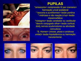 PUPILAS
*anisocoria= compressão III par craniano=
         herniação uncal ipsilateral
  * Isocoria e puntiformes= lesão pontina
     * midríase e não reação à luz= lesão
               mesencefálica
 *nistagmo= lesão cerebelar ou vestibular
  *desvio conjugado olhar= lesão cortical,
  disfç nervos oculomotores ou atividade
                  convulsiva
   *S. Horner= (miose, ptose e anidrose
 unilat)= lesão hipotalâmica ou herniação
                transtentorial.
 