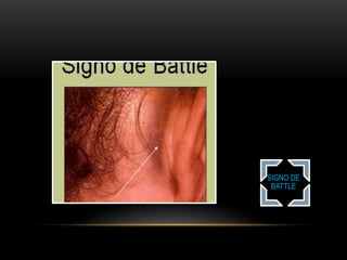 TRAUMATISMO CRANEOENCEFALICO | PPTX