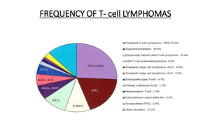 FREQUENCY OF T- cell LYMPHOMAS
 