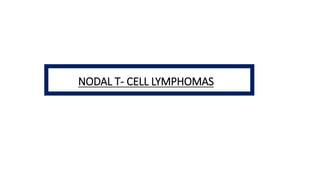 NODAL T- CELL LYMPHOMAS
 