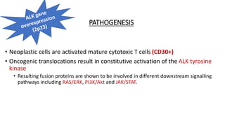 PATHOGENESIS
• Neoplastic cells are activated mature cytotoxic T cells (CD30+)
• Oncogenic translocations result in constitutive activation of the ALK tyrosine
kinase
• Resulting fusion proteins are shown to be involved in different downstream signalling
pathways including RAS/ERK, PI3K/Akt and JAK/STAT.
 