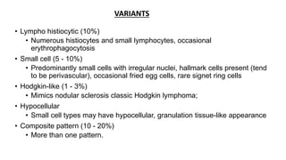 • Lympho histiocytic (10%)
• Numerous histiocytes and small lymphocytes, occasional
erythrophagocytosis
• Small cell (5 - 10%)
• Predominantly small cells with irregular nuclei, hallmark cells present (tend
to be perivascular), occasional fried egg cells, rare signet ring cells
• Hodgkin-like (1 - 3%)
• Mimics nodular sclerosis classic Hodgkin lymphoma;
• Hypocellular
• Small cell types may have hypocellular, granulation tissue-like appearance
• Composite pattern (10 - 20%)
• More than one pattern.
VARIANTS
 