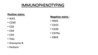 IMMUNOPHENOTYPING
Positive stains:
• ALK1
• CD30
• CD2
• CD4
• CD5
• TIA1
• Granzyme B
• Perforin
Negative stains :
• PAX5
• CD15
• CD20
• CD79a
• EBER
 
