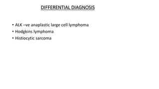 DIFFERENTIAL DIAGNOSIS
• ALK –ve anaplastic large cell lymphoma
• Hodgkins lymphoma
• Histiocytic sarcoma
 