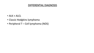 DIFFERENTIAL DIAGNOSIS
• ALK + ALCL
• Classic Hodgkins lymphoma
• Peripheral T – Cell lymphoma (NOS)
 