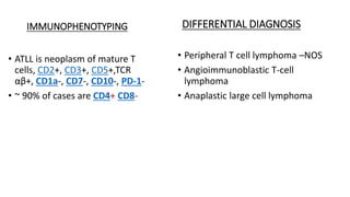 IMMUNOPHENOTYPING
• ATLL is neoplasm of mature T
cells, CD2+, CD3+, CD5+,TCR
αβ+, CD1a-, CD7-, CD10-, PD-1-
• ~ 90% of cases are CD4+ CD8-
DIFFERENTIAL DIAGNOSIS
• Peripheral T cell lymphoma –NOS
• Angioimmunoblastic T-cell
lymphoma
• Anaplastic large cell lymphoma
 