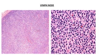 LYMPH NODE
 