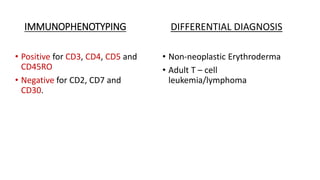 IMMUNOPHENOTYPING
• Positive for CD3, CD4, CD5 and
CD45RO
• Negative for CD2, CD7 and
CD30.
DIFFERENTIAL DIAGNOSIS
• Non-neoplastic Erythroderma
• Adult T – cell
leukemia/lymphoma
 