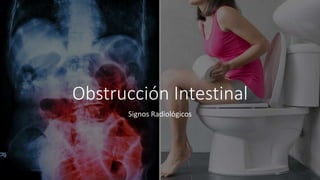 Obstrucción Intestinal
Signos Radiológicos
 