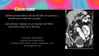 •
•
•
 Hidrosoluble (Bario) diluido 60-120 min previos a
estudio para evalución y grado.
 Contraste Yodado en un volumen de 100ml
inyectado a flujo de 2-3ml/seg
 