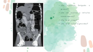 • ¿
• ¿
• ¿
• ¿
 