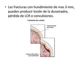 • Las fracturas con hundimiento de mas 3 mm,
pueden producir lesión de la duramadre,
pérdida de LCR o convulsiones.
 