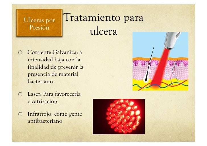 Los preparados rusos de varikoza