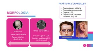 20
BÓVEDA
Lineal o estrellada
Deprimida /no
deprimida
BASE DE CRÉNEO
Con/sin fuga de LCR
Con/sin parálisis del VII
nervio craneal
 Equimosis peri orbitaria
 Equimosis retro auricular
 Fuga de LCR
 Disfunción de los pares
craneales VII y VIII
 