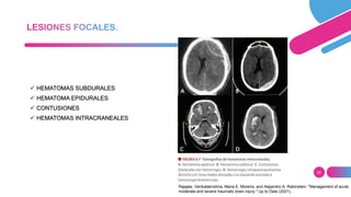 24
 HEMATOMAS SUBDURALES
 HEMATOMA EPIDURALES
 CONTUSIONES
 HEMATOMAS INTRACRANEALES
Rajajee, Venkatakrishna, Maria E. Moreira, and Alejandro A. Rabinstein. "Management of acute
moderate and severe traumatic brain injury." Up to Date (2021).
 