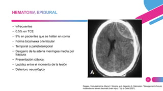 25
• Infrecuentes
• 0.5% en TCE
• 9% en pacientes que se hallan en coma
• Forma biconvexa o lenticular
• Temporal o parietotemporal
• Desgarro de la arteria meníngea media por
fractura
• Presentación clásica:
• Lucidez entre el momento de la lesión
• Deterioro neurológico
Rajajee, Venkatakrishna, Maria E. Moreira, and Alejandro A. Rabinstein. "Management of acute
moderate and severe traumatic brain injury." Up to Date (2021).
 