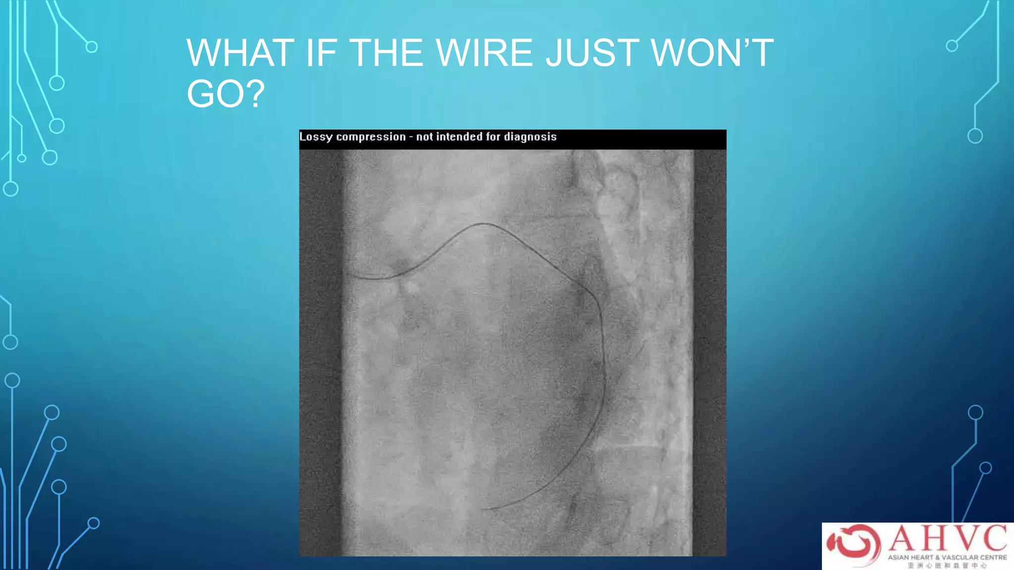 WHAT IF THE WIRE JUST WON’T
GO?
 