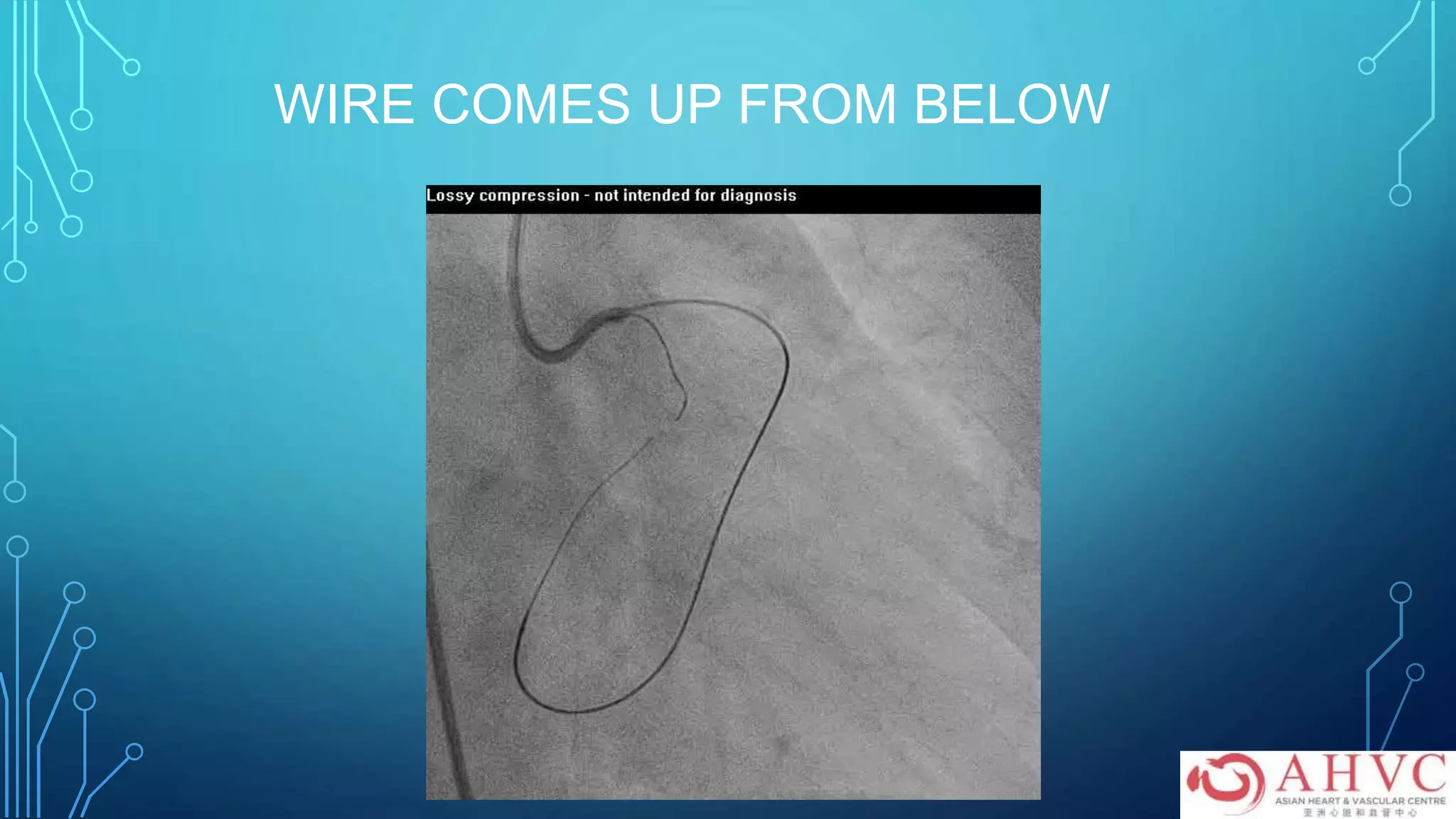 WIRE COMES UP FROM BELOW
 