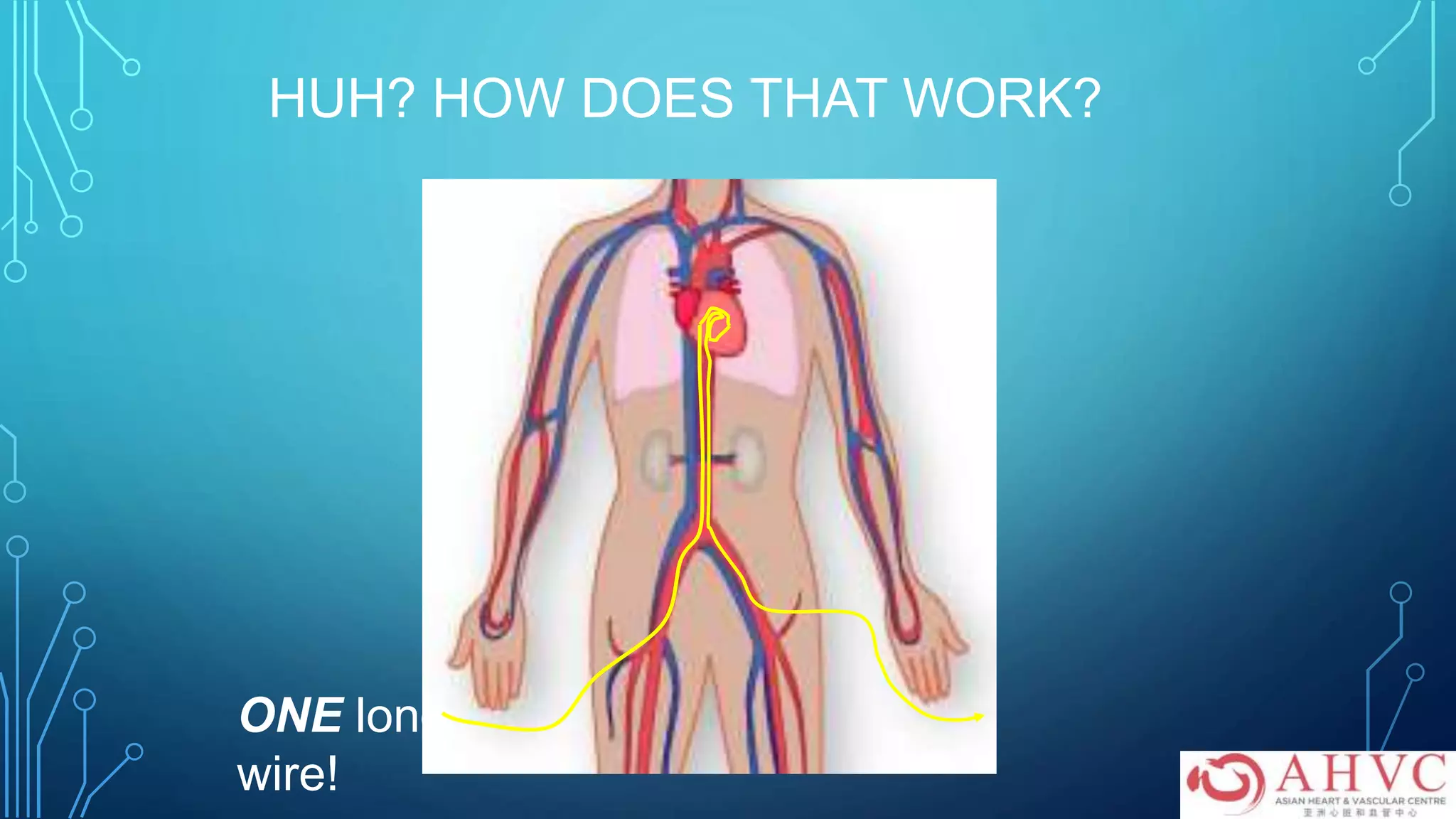 HUH? HOW DOES THAT WORK?
ONE long
wire!
 