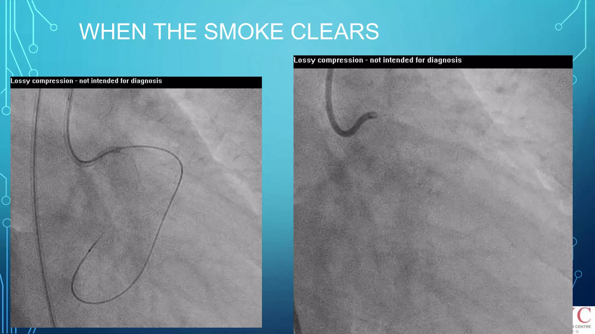 WHEN THE SMOKE CLEARS
 