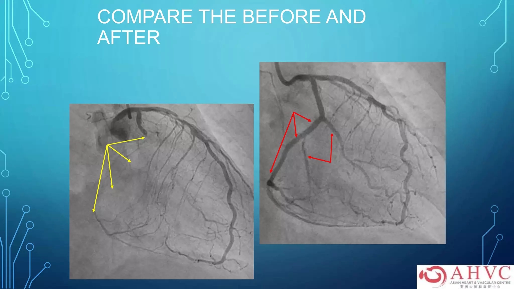 COMPARE THE BEFORE AND
AFTER
 