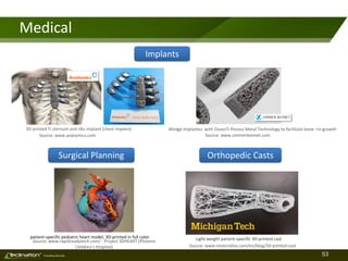 53TM
Consulting Services
Medical
3D printed Ti sternum and ribs implant (chest implant)
Source: www.materialise.com/en/blog/3d-printed-cast
Source: www.rapidreadytech.com/ - Project 3DHEART (Phoenix
Children’s hospital)
Source: www.anatomics.com
Wedge implantes with OsseoTi Porous Metal Technology to facilitate bone –in-growth
Source: www.zimmerbiomet.com
patient-specific pediatric heart model, 3D-printed in full color. Light-weight patient-specific 3D-printed cast
Implants
Surgical Planning Orthopedic Casts
 