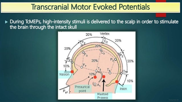 transcranial doppler guidelines transcranial doppler guidelines